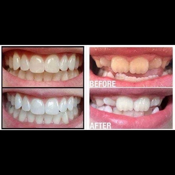 Nuskin Whitening Fluoride Toothpaste - Picture 4 of 8